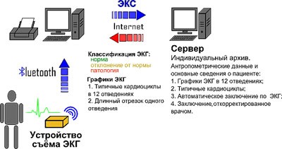хема передачи электрокардиограммы через Bluetooth персонального компьютера на сервер с помощью устройства съема ЭКГ