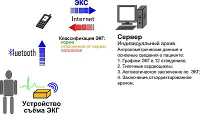 Схема ЭКГ-телеметрии