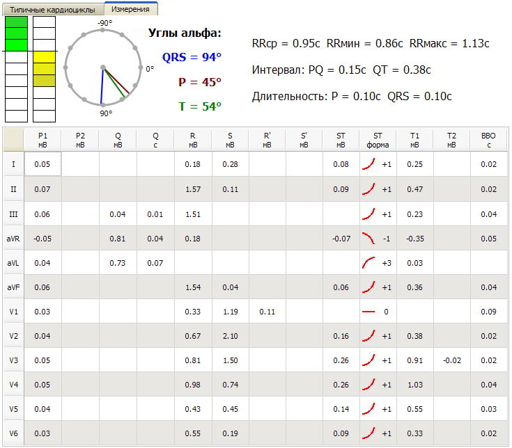 Таблица измеренных значений амплитудно-временных параметров ЭКГ